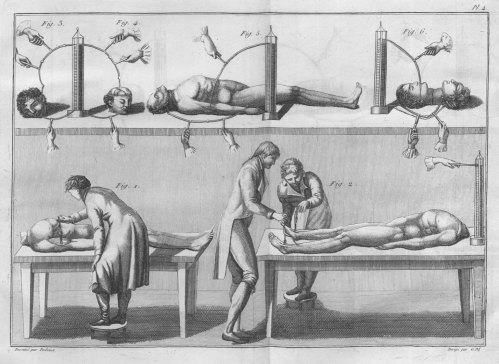 Experiments with cadavers and severed heads - Essai théorique et expérimental sur le galvanisme  1804